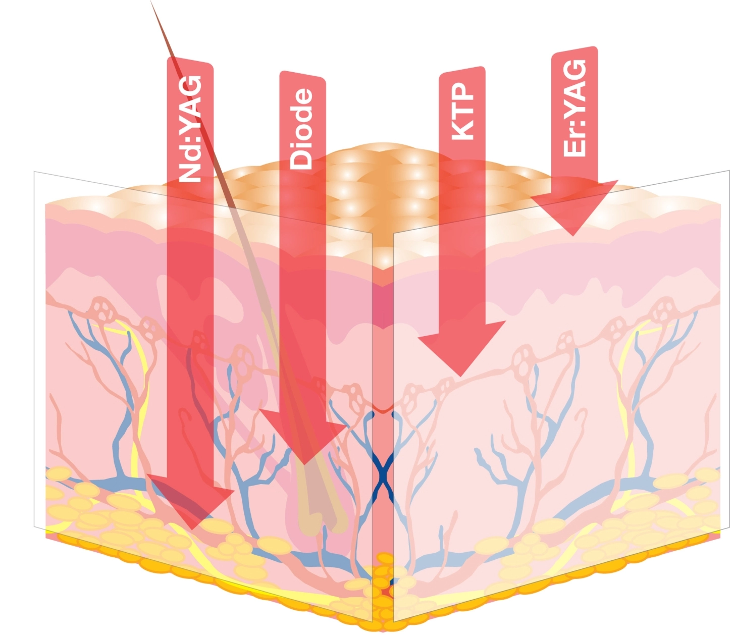 14942Fotona 4D - Skin Cubes Wavelenght 1.jpg (1)