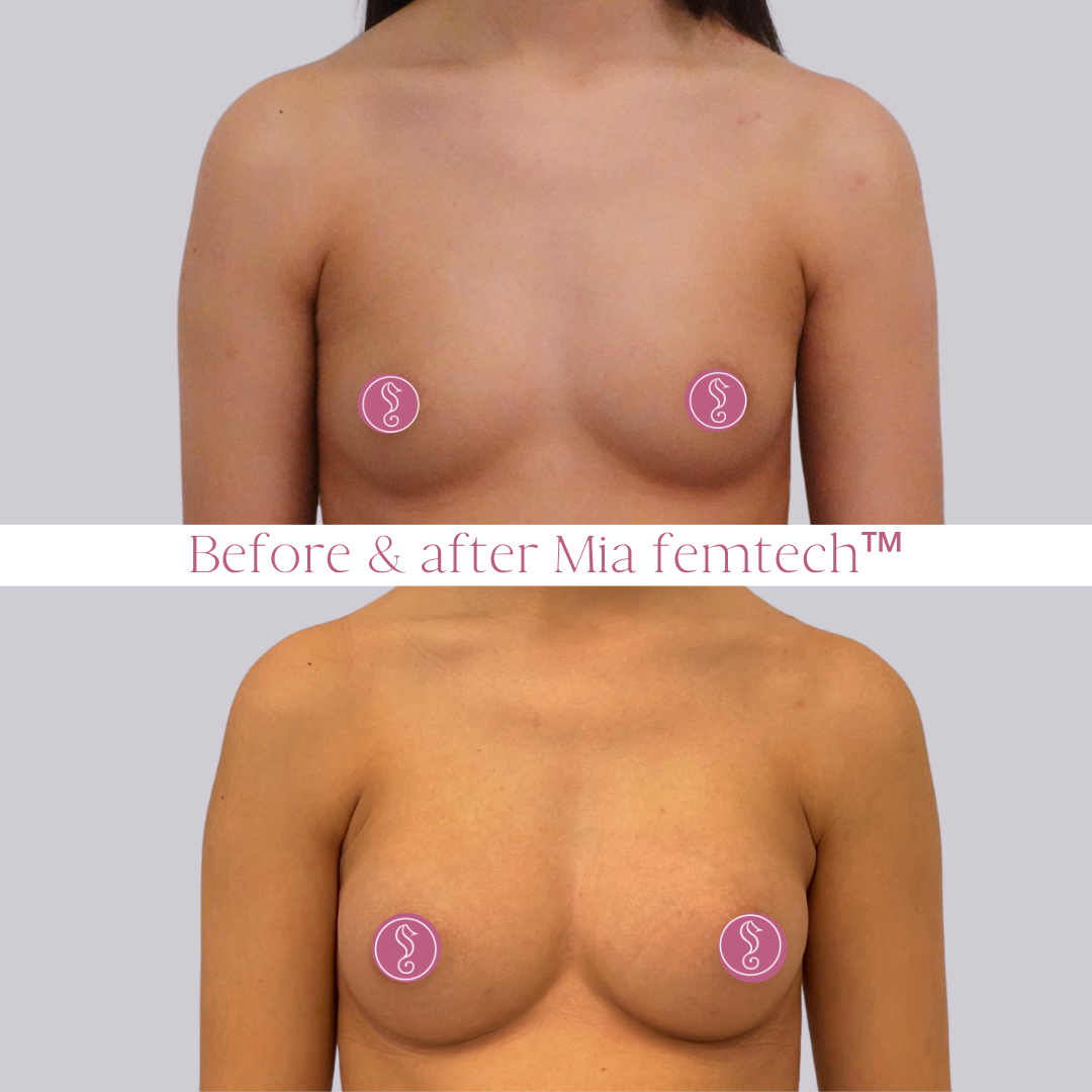 TT Mia Full 190 - KVpng TT Mia Full 190 - KVpng